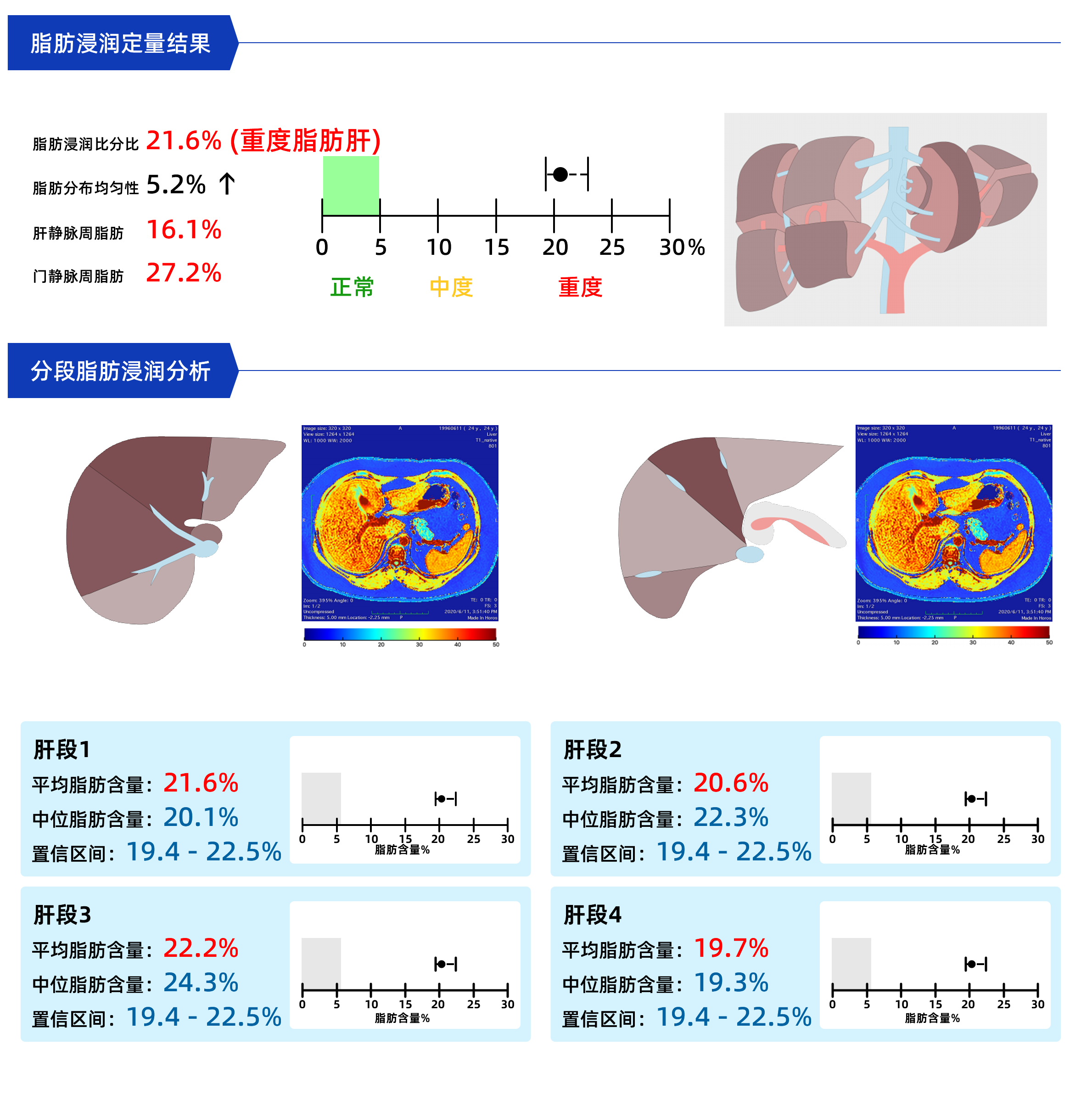 undefined 1.1 拷貝.png